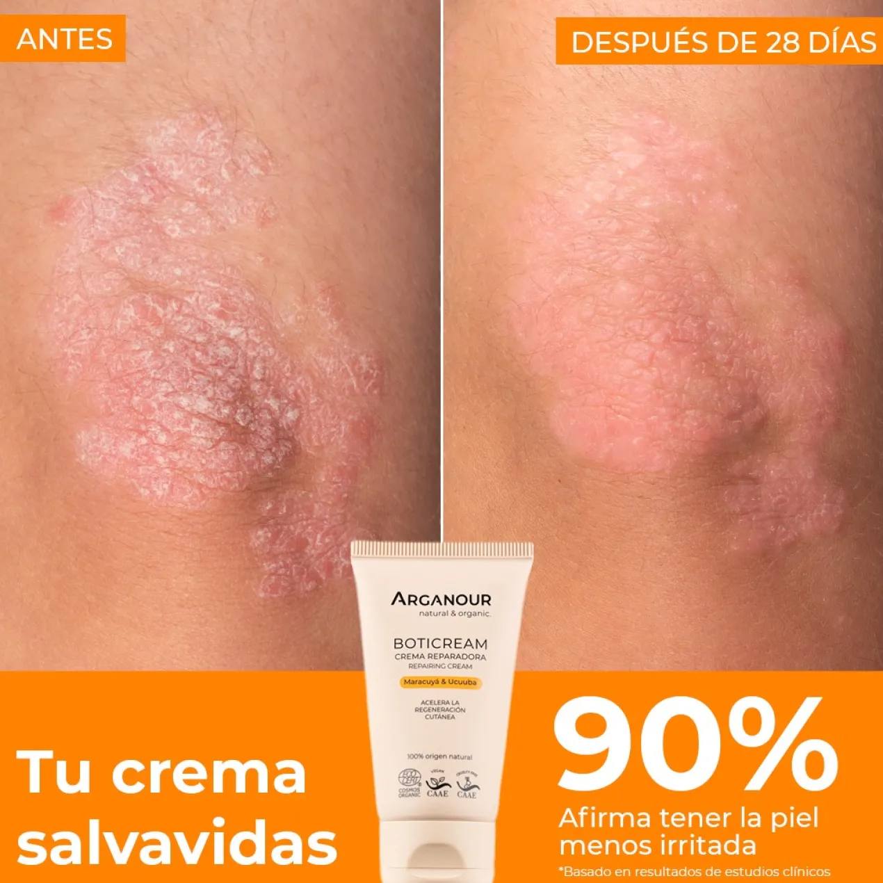 Boticream Crema Reparadora