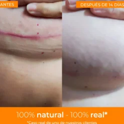 Boticream Crema Reparadora