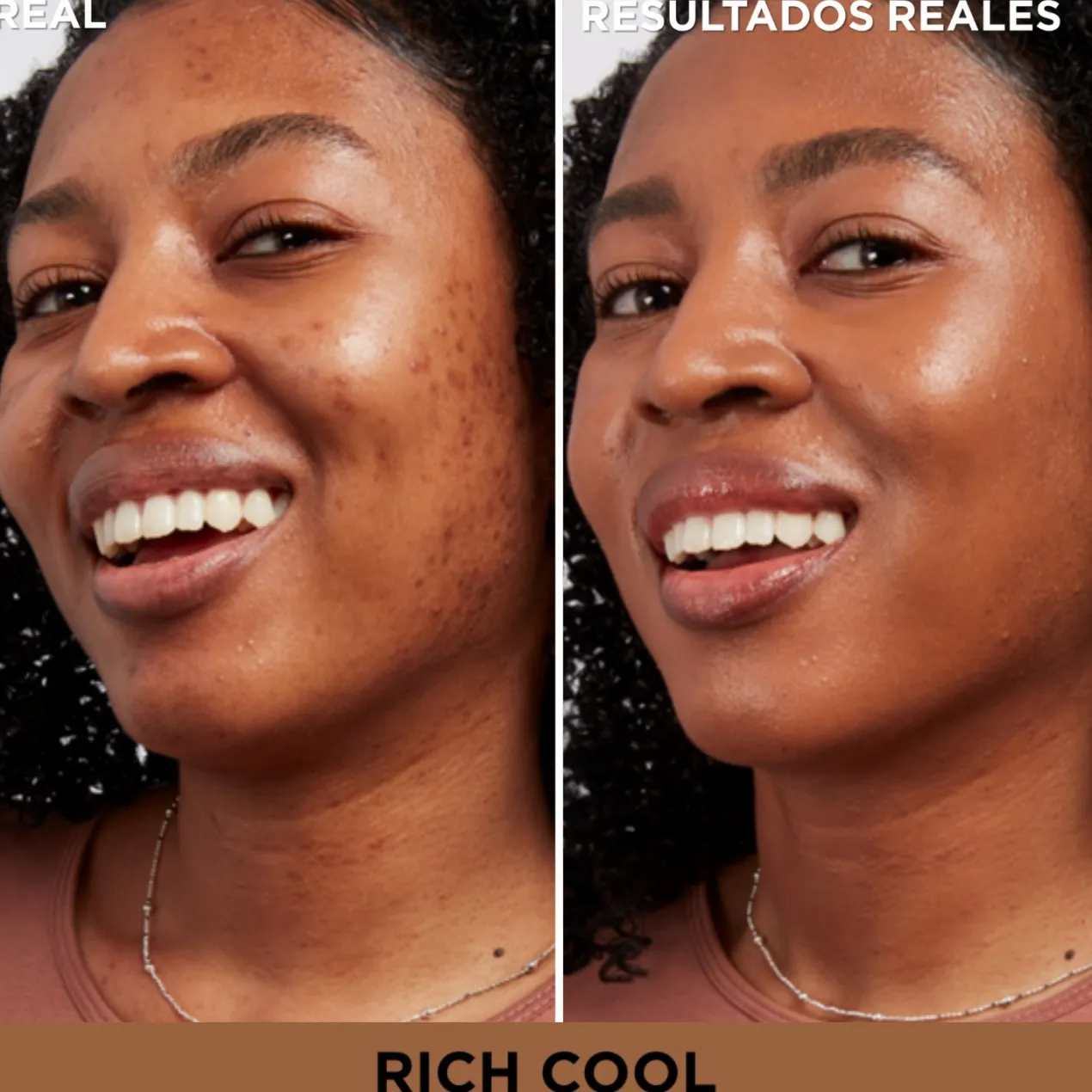 Bye Bye Corrector Manchas Oscuras + Sérum