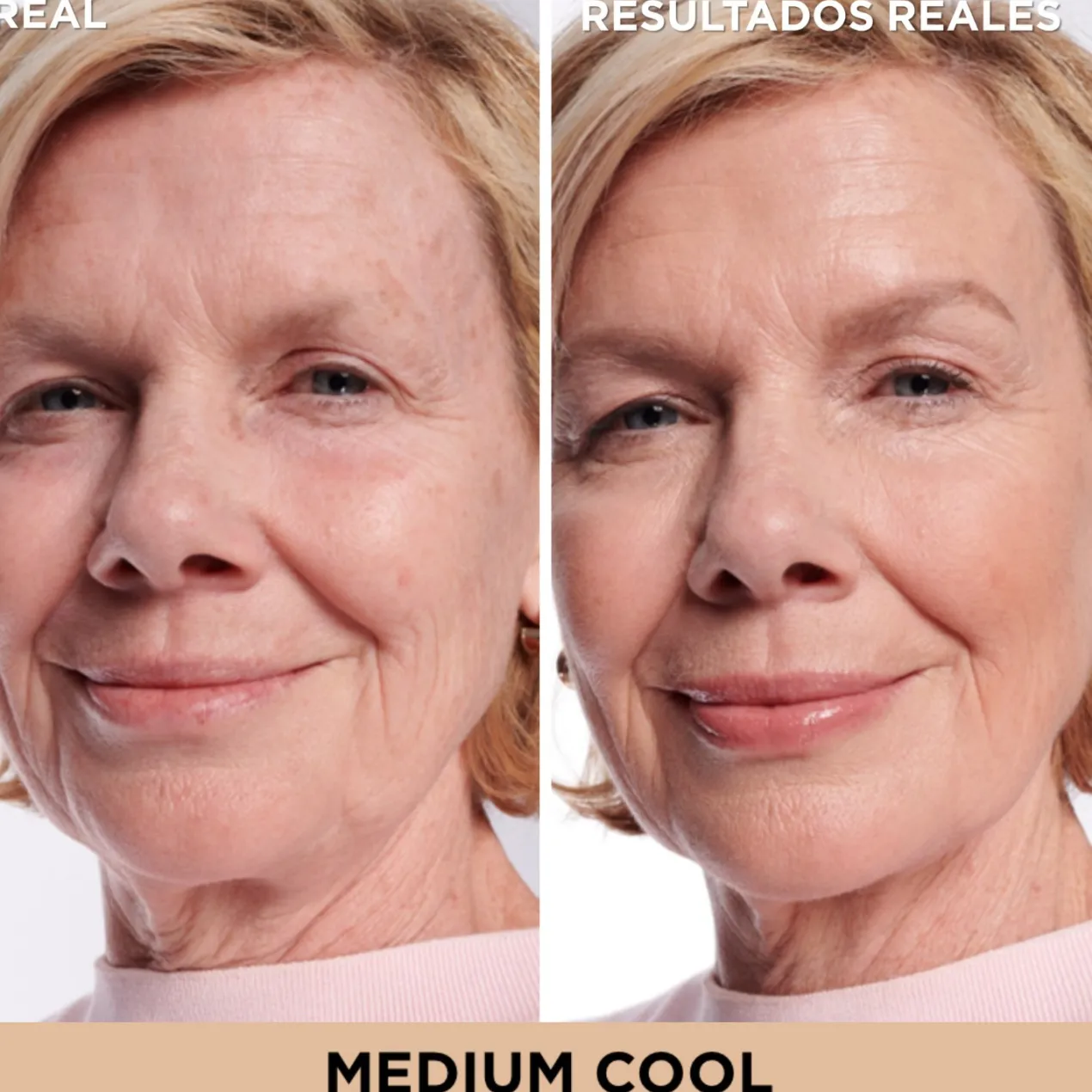 Bye Bye Corrector Manchas Oscuras + Sérum