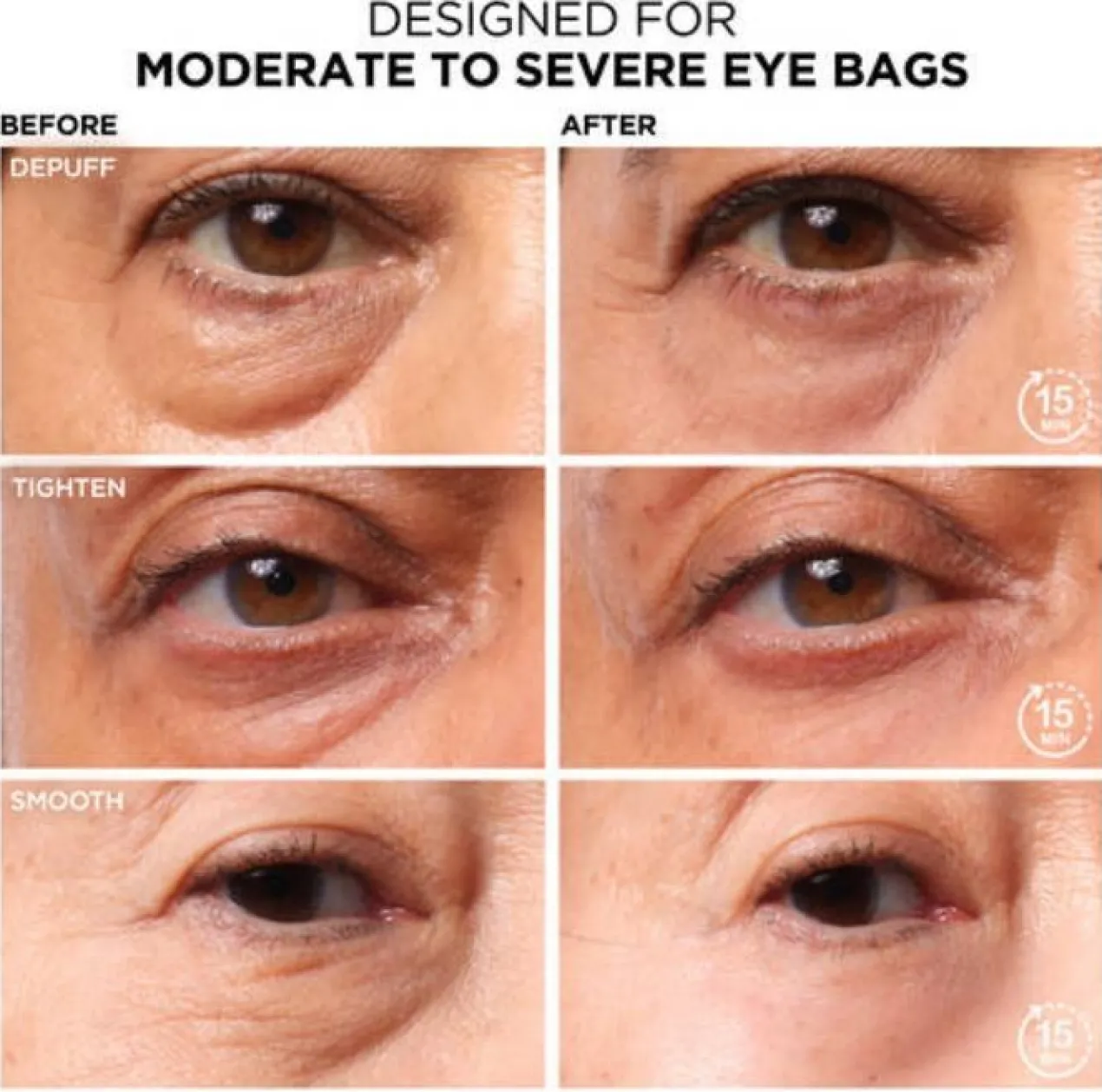 Bye Bye Under Eye Bag Tratamiento Anti Ojeras