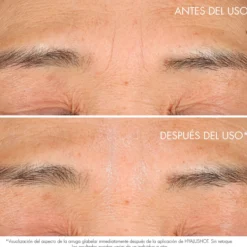 Capture Totale Hyalushot Corrector de Arrugas