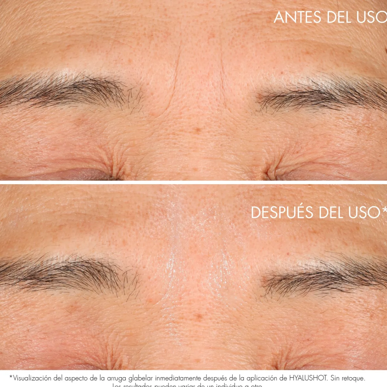 Capture Totale Hyalushot Corrector de Arrugas