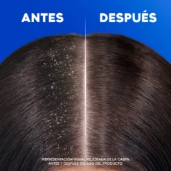 Citrus Fresh Champú Anticaspa