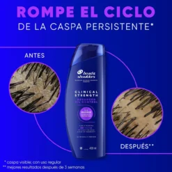 Clinical Strength Champú Detox