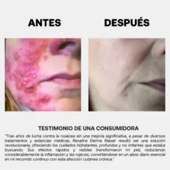 Derma Repair Crème Crema Reparadora y Calmante