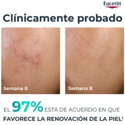 DermoPure Clinical Peeling 10