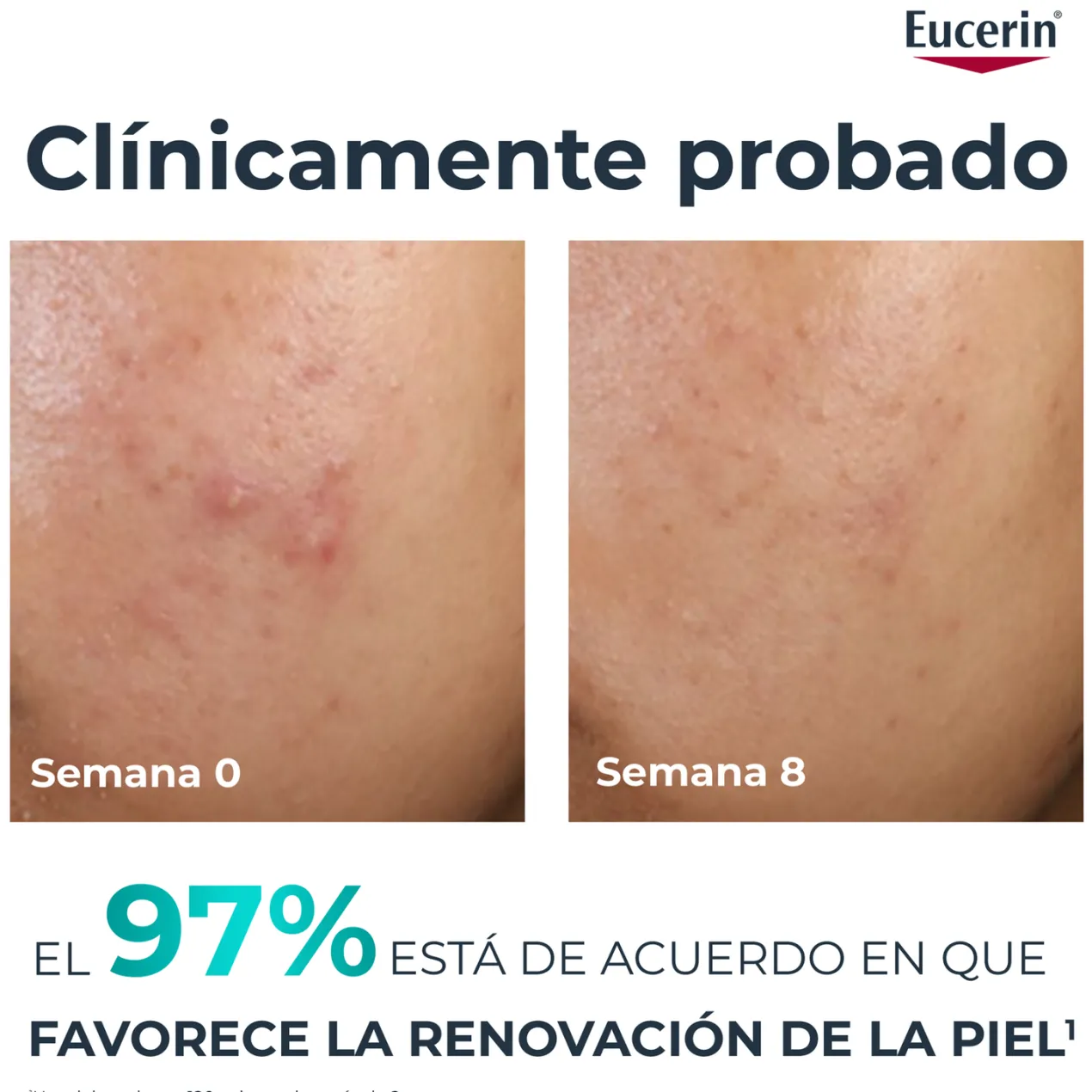 DermoPure Clinical Peeling 10