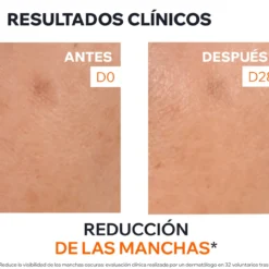 Dépiderm Sérum Antimanchas