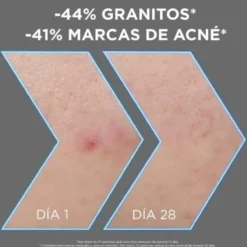 Garnier Pure Active Serum Anti-Imperfecciones con Niacinamida