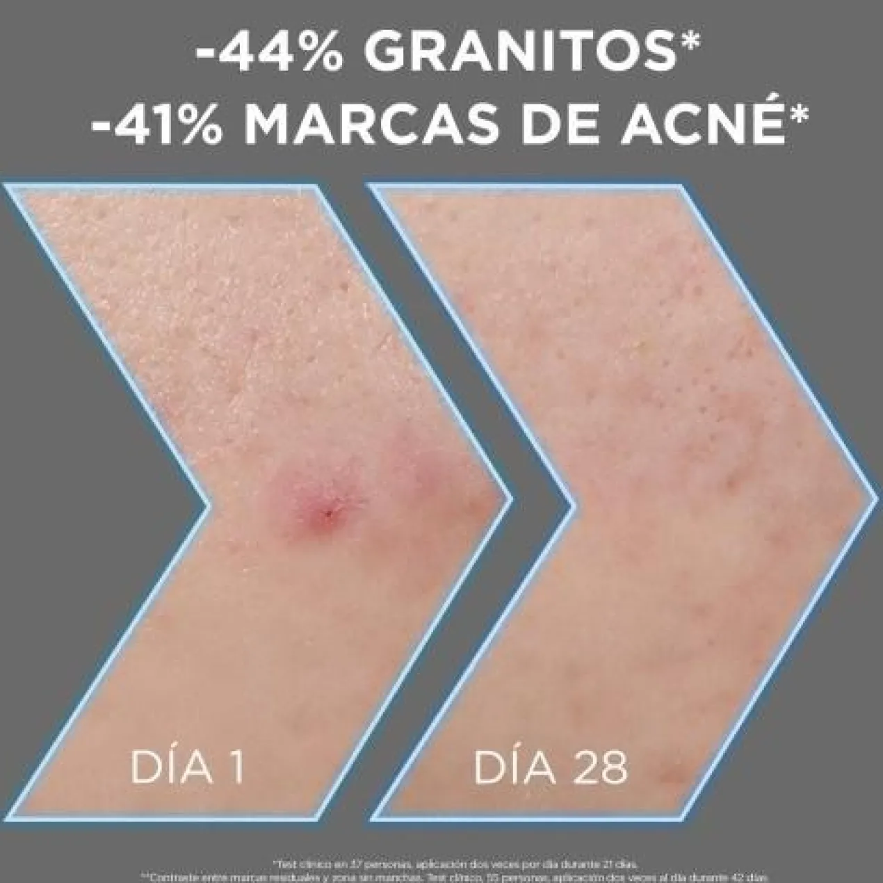 Garnier Pure Active Serum Anti-Imperfecciones con Niacinamida