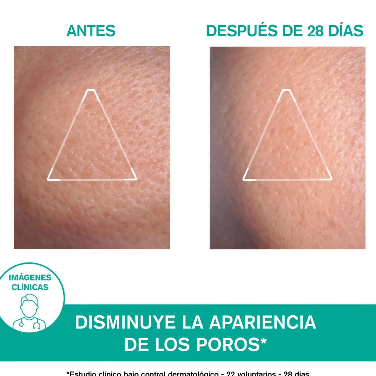 Hyséac Mat Gel-Crema Matificante