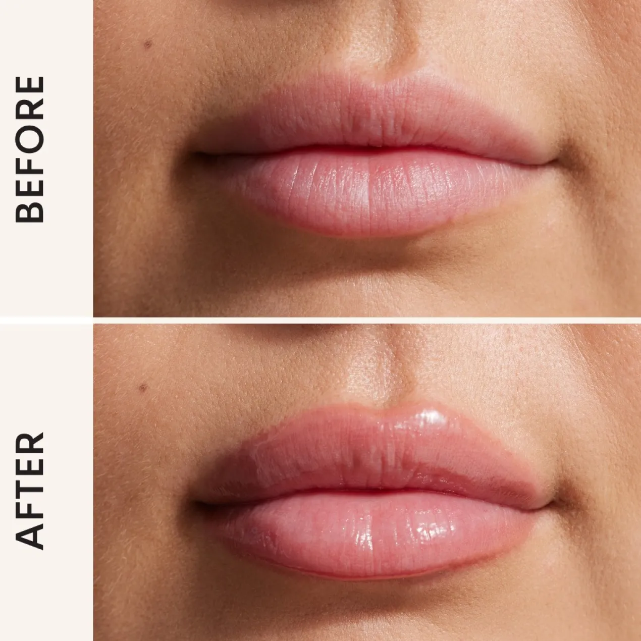 Lip Filler Plumpling Voluminizador