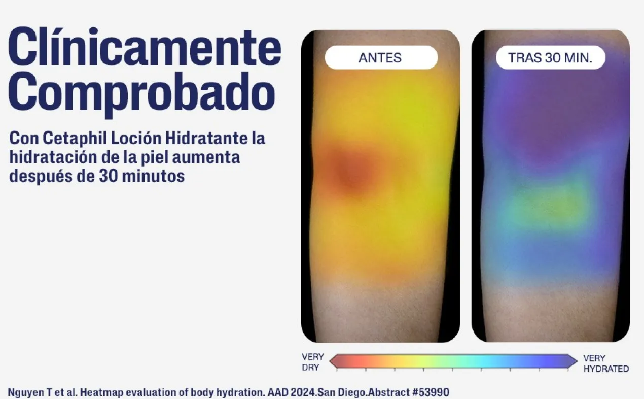 Loción Hidratante 48H