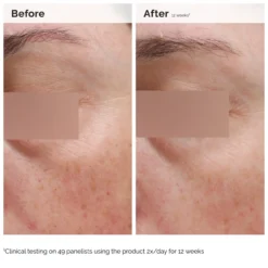 Niacinamide 5% Face and Body Emulsion