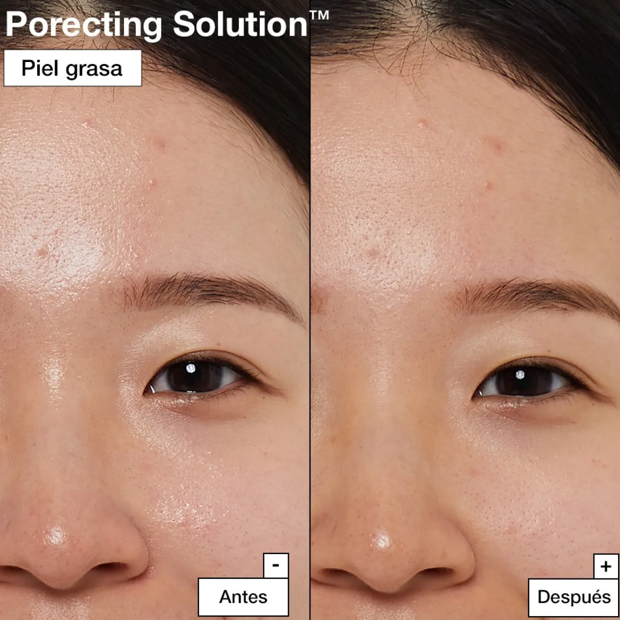 Porecting Solution Mascarilla Facial Limpiadora de Poros