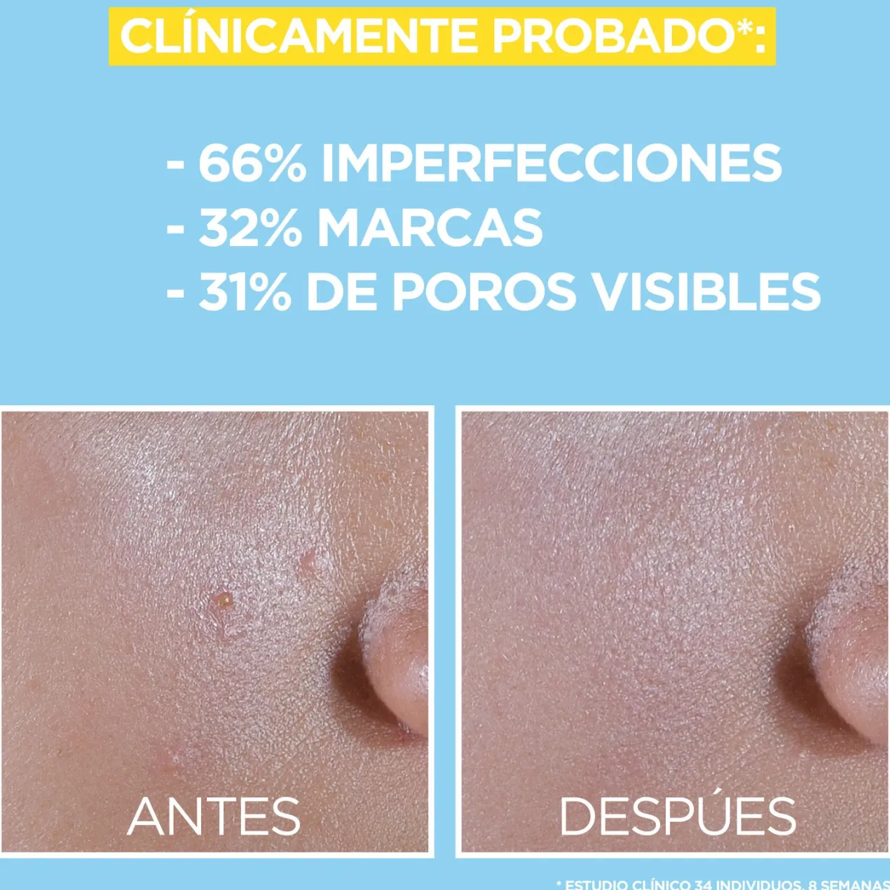 Pure Active Fluido UV Diario con BHA + Niacinamida FPS50+