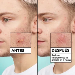 Pure Active Pimple Patch Invisible 8h Parche con Tecnología Hidrocoloide con BHA para Granitos