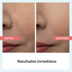 Reductor de Poros al Instante