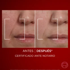 Revitalift Laser Crema de día