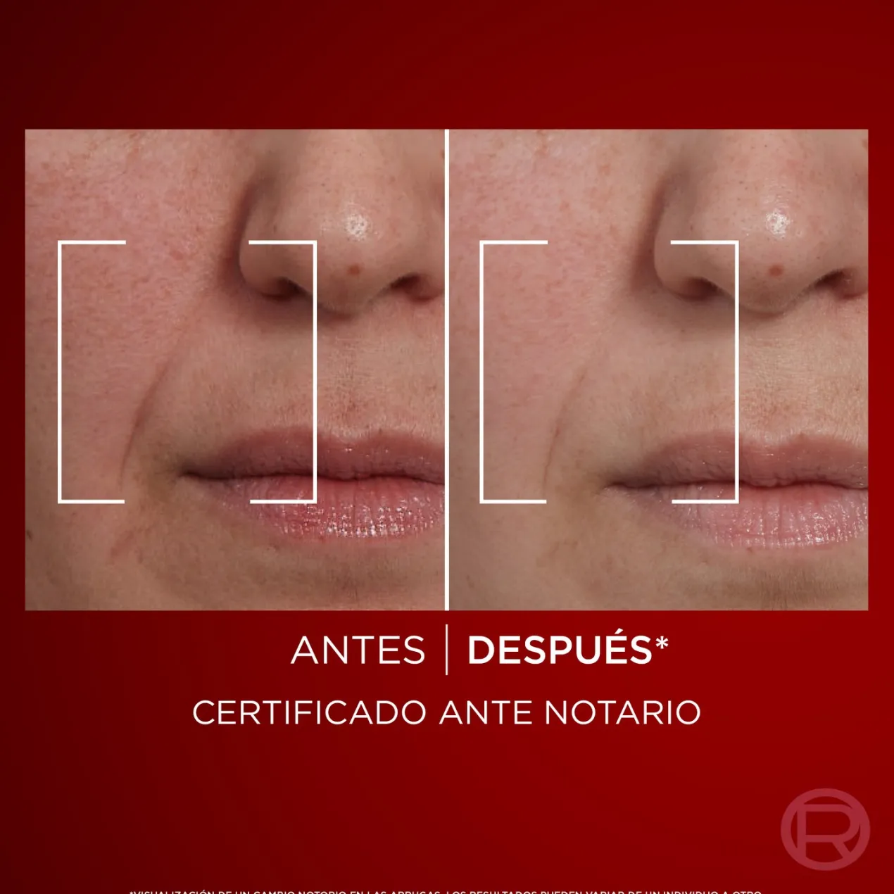 Revitalift Laser Crema de día