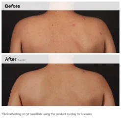 Salicylic Acid 0.5% Body Serum Anti Imperfecciones
