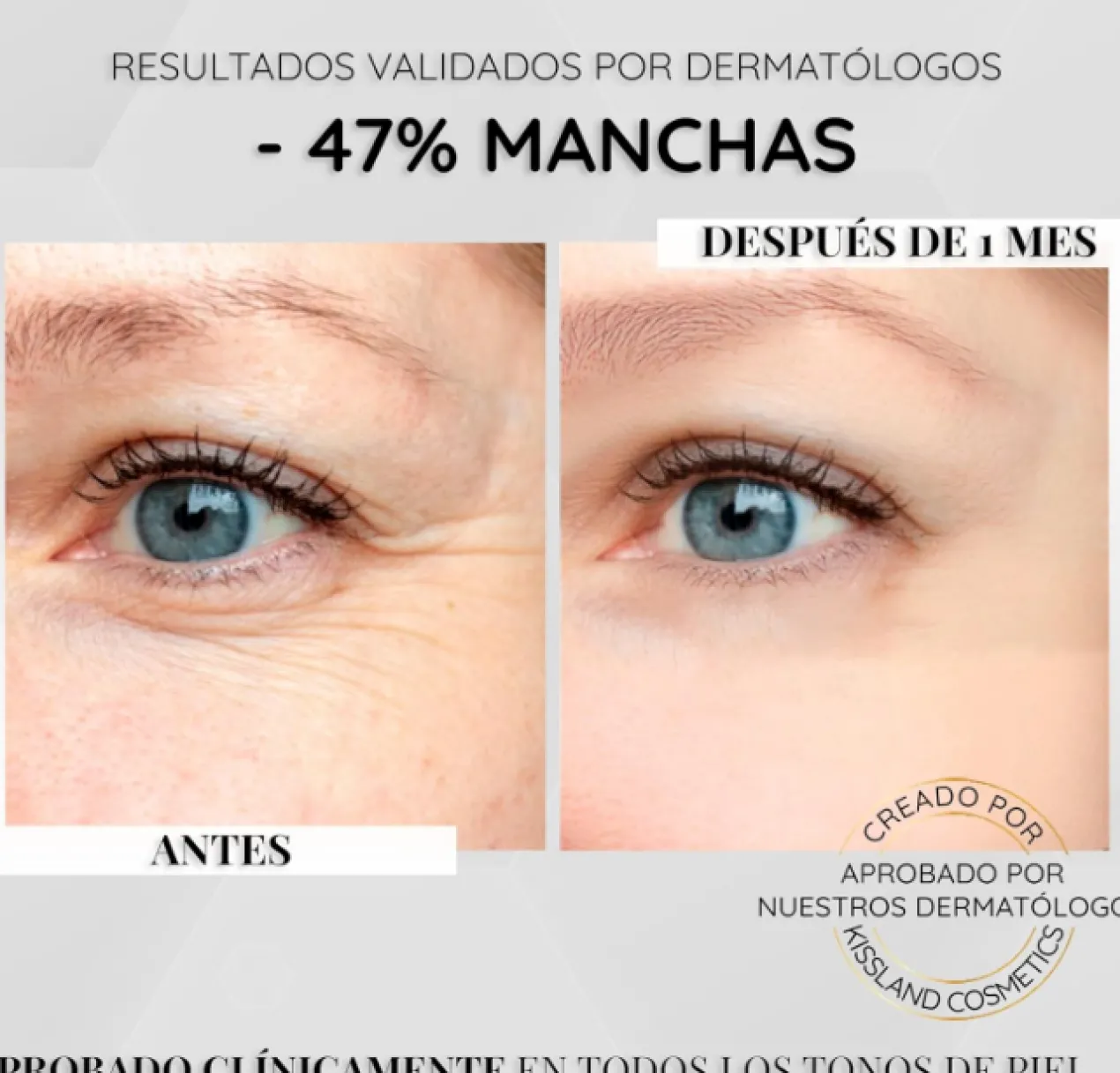 Serum Antimanchas Facial Niacinamida