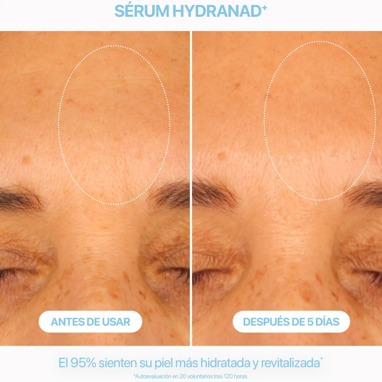 Serum Hydranad+