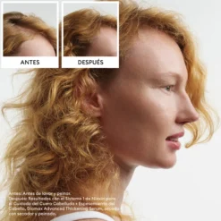 Sistema 1 Scalp & Hair Treatment Sérum Capilar Densificador