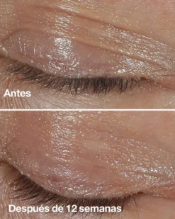Smart Clinical Repair Crema Contorno de Ojos