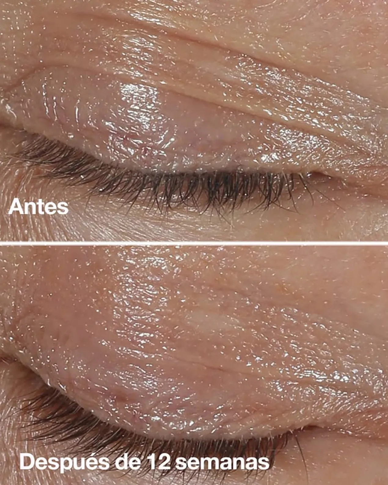Smart Clinical Repair Crema Contorno de Ojos