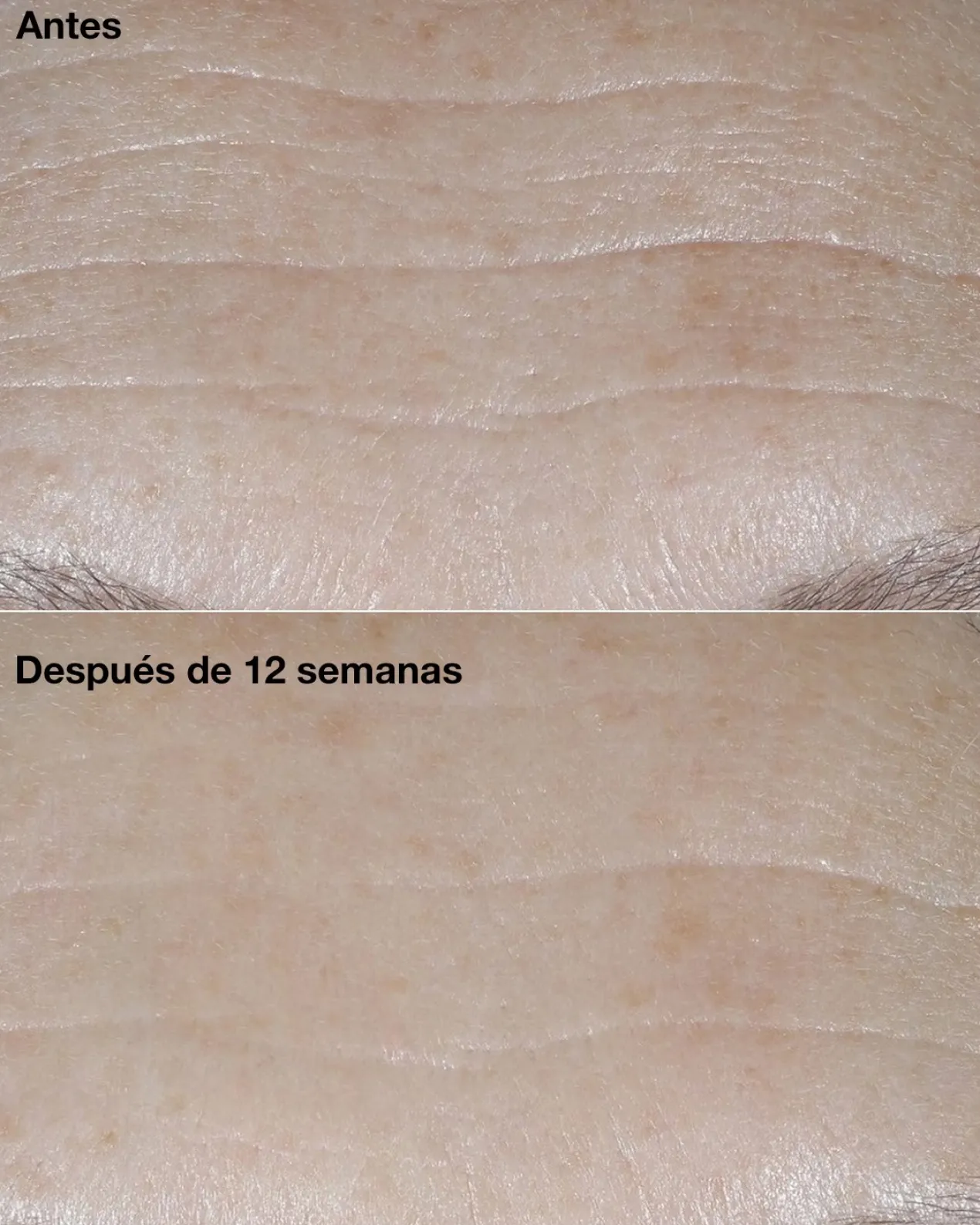Smart Clinical Repair SPF30 Crema Correctora de Arrugas