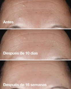 Smart Clinical Repair Sérum Corrector de Arrugas