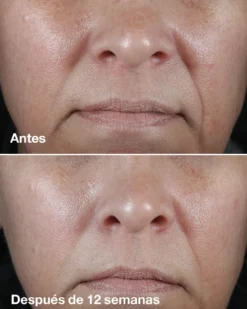 Smart Clinical Repair Wrinkle Correcting Crema Antiarrugas