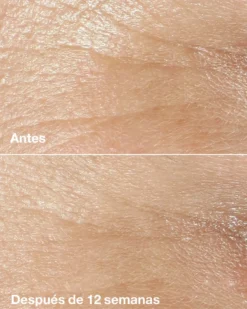 Smart Clinical Repair Wrinkle Correcting Crema Antiarrugas