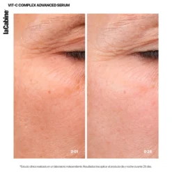 Sérum Avanzado 25% Vit-Complex
