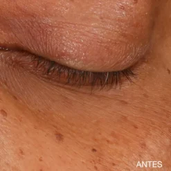 Sérum Concentrado Iluminador para el Contorno de Ojos