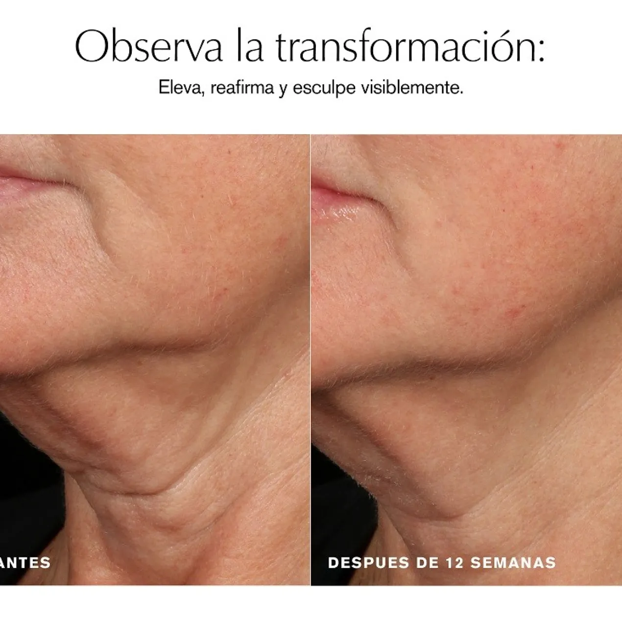 Sérum Facial Reafirmante Revitalizing Supreme+
