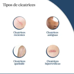 Tratamiento Reductor de Cicatrices