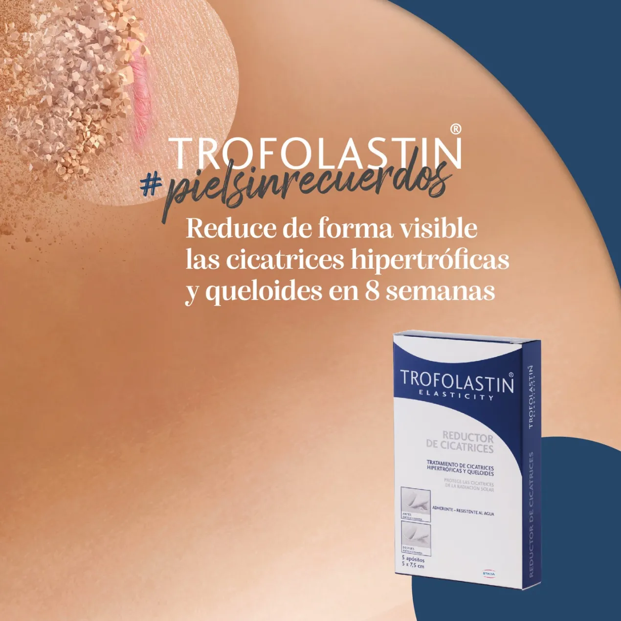 Tratamiento Reductor de Cicatrices