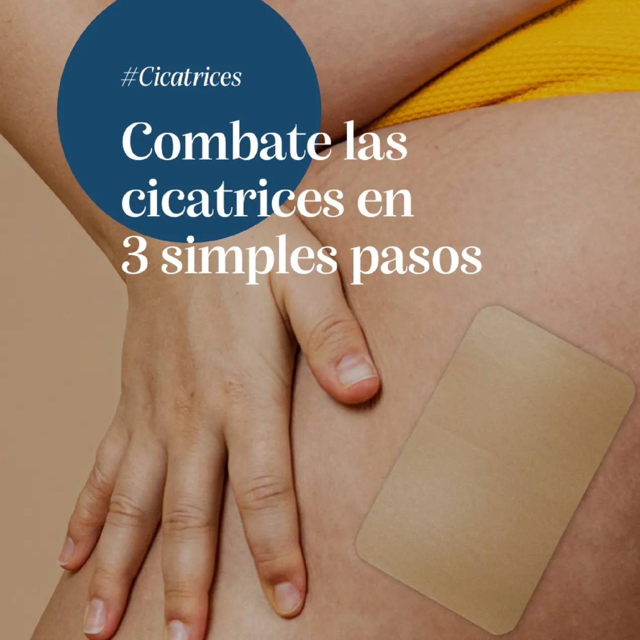 Tratamiento Reductor de Cicatrices