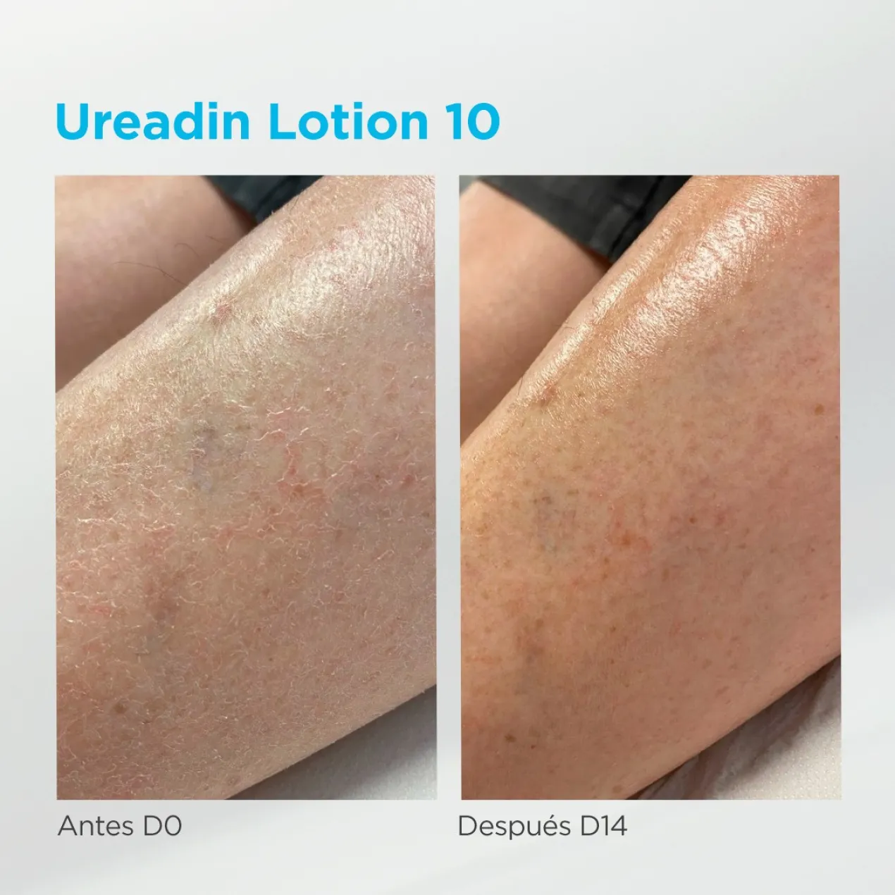 Ureadin Loción Rehidratante Piel Seca