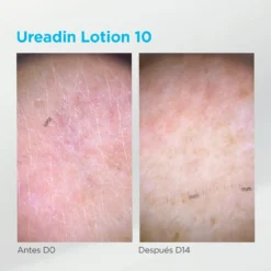 Ureadin Loción Rehidratante Piel Seca