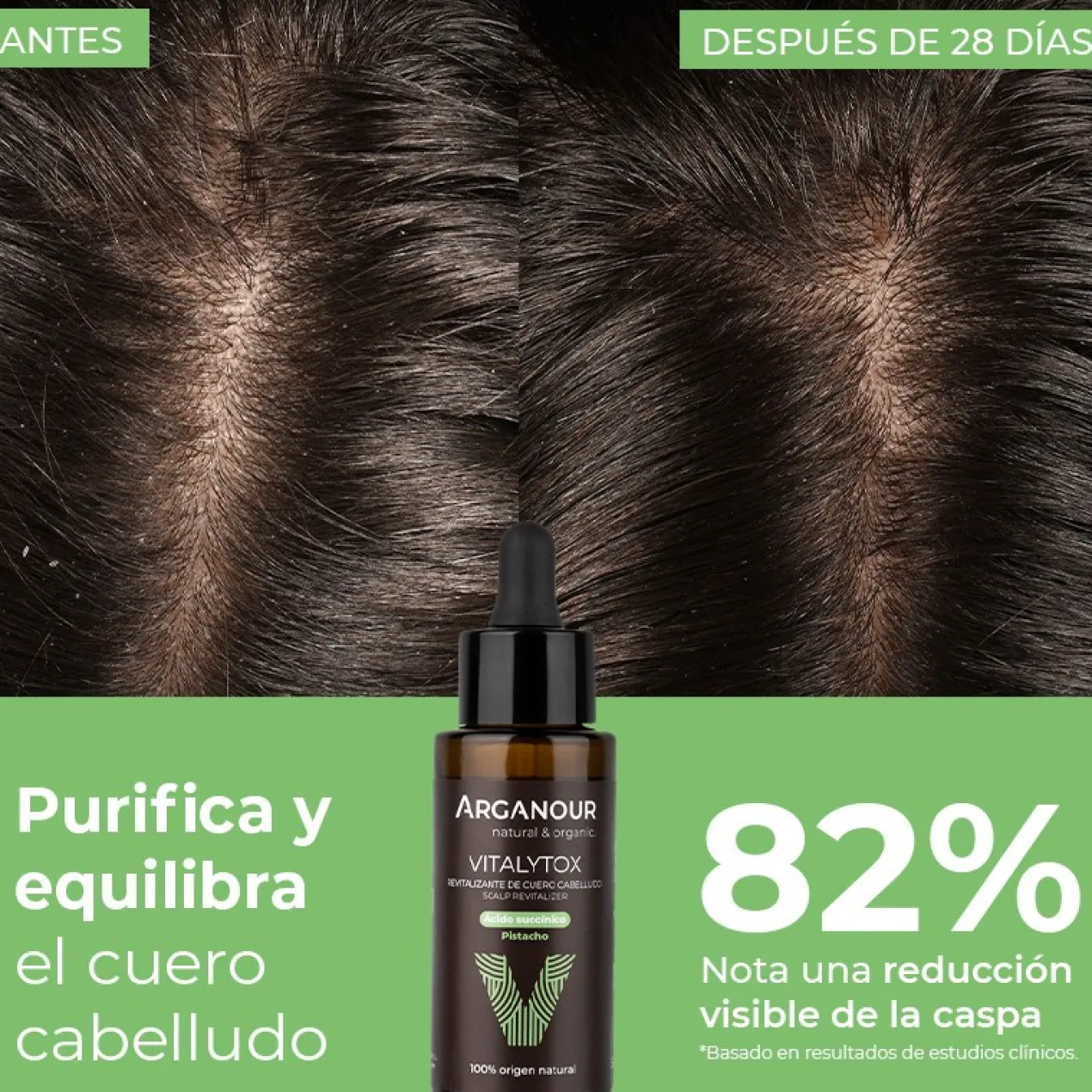 Vitalytox Revitalizante de Cuero Cabelludo