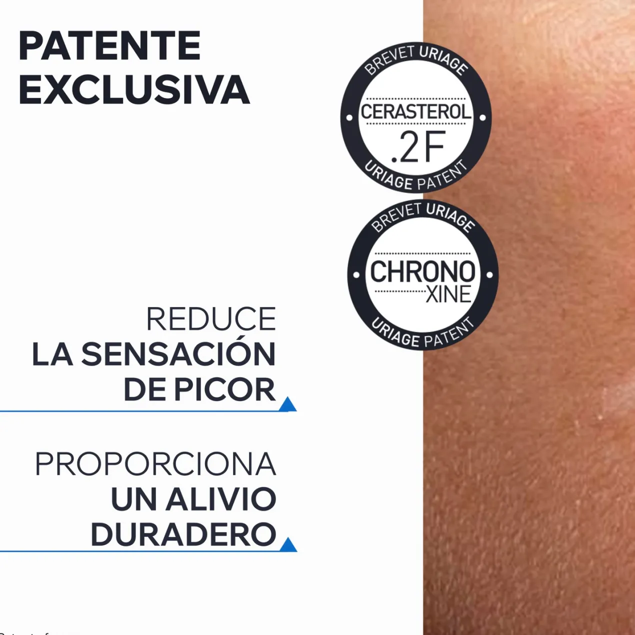 Xemose C8+ Aceite Limpiador Anti-picor